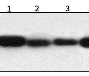 BCL-2 - Image 3