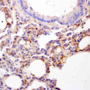 BCL-2 - Image 6